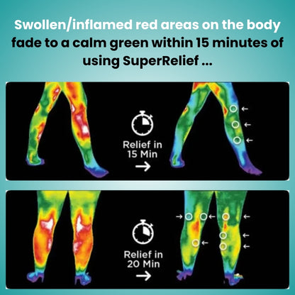 SuperRelief™ - Knee Massager