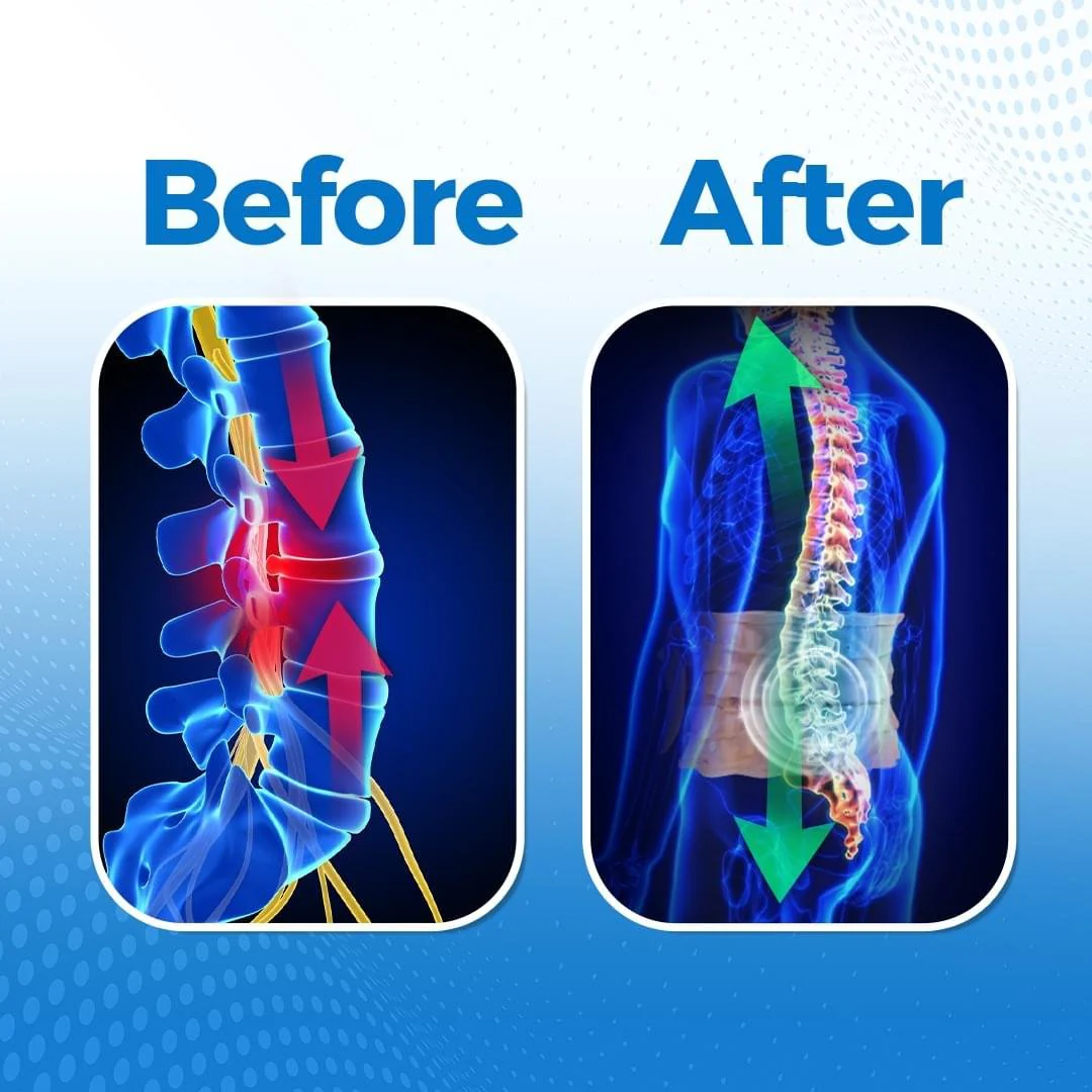 SuperRelief™ Lumbar Decompression Belt